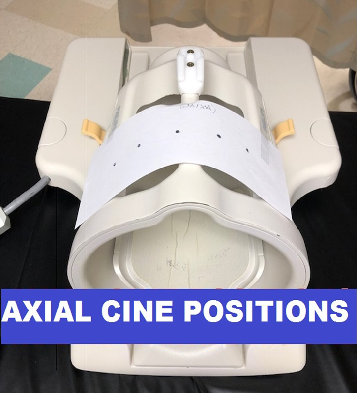 MR Orbits WO with Cine ENT Protocol axial cine position image