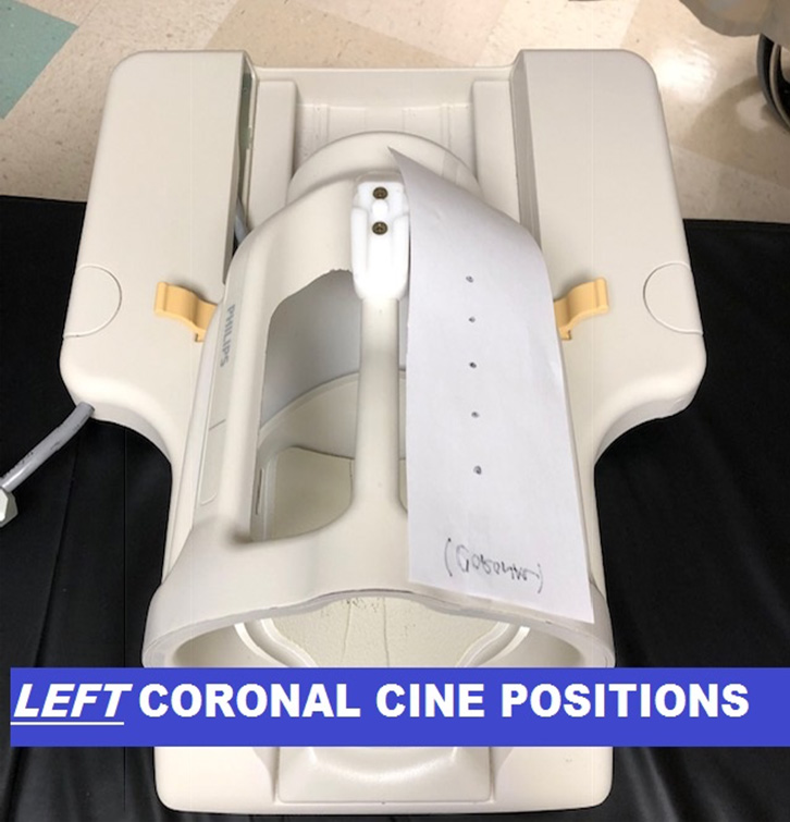 MR Orbits WO with Cine ENT Protocol left coronal cine position image