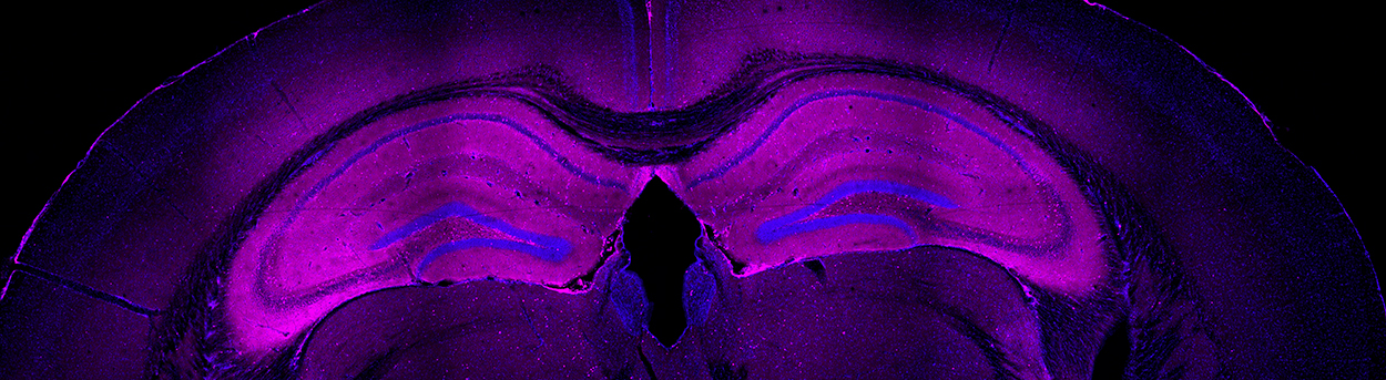 Adult mouse brain showing inflammatory infiltrates characteristic of encephalitis