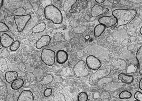 Image depicts an electron micrograph of a demyelinated optic nerve following adult ablation of the Myrf gene.
