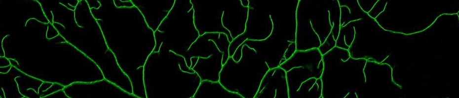 Abstract image: bright green lines webbing out like tree branches over a black background 
