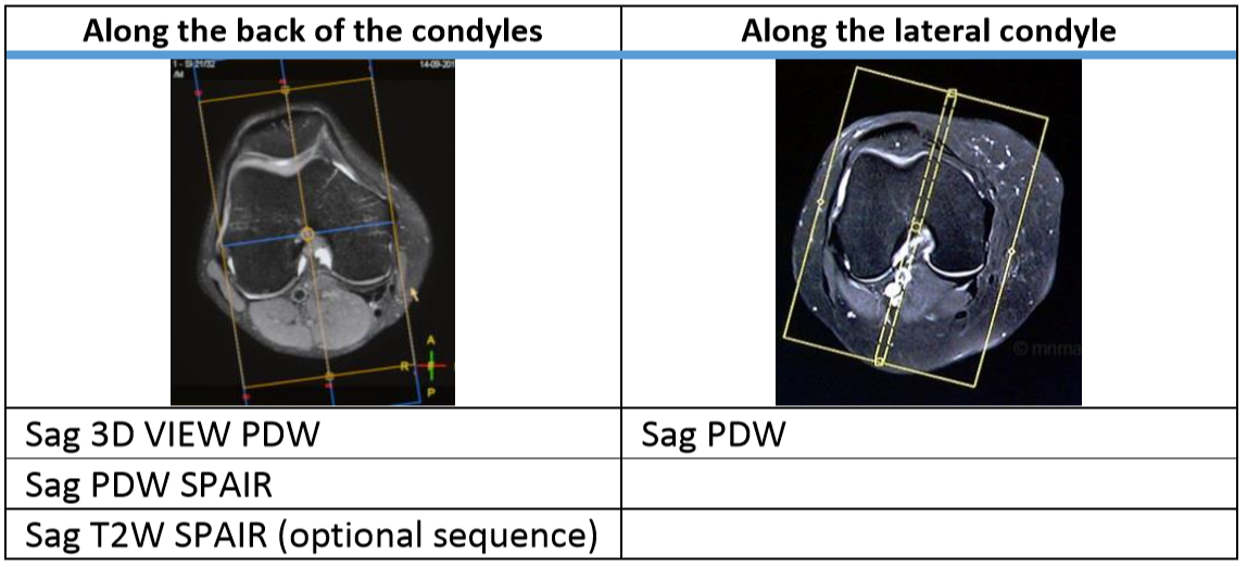 Sagittal Angulations to provide planning guide for MRI technologists