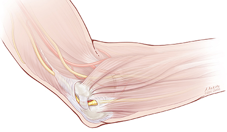 Inside the elbow, muscles and nerves diagram.