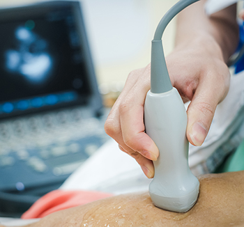 An echocardiogram being performed with laptop in the background