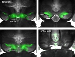 Brain slices that show, in green, dopamine neurons