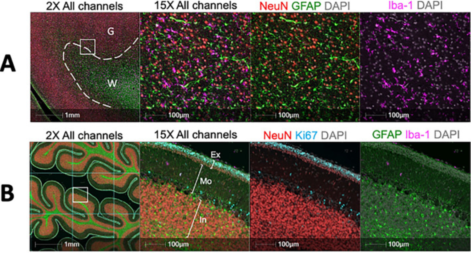 OHSU Lo Lab multiplex scan of cerebellum