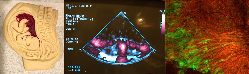 Plancental research