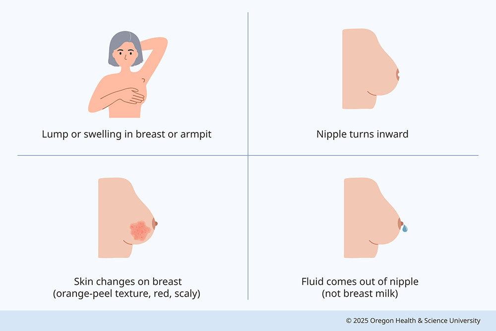 A graphic shows women of different ethnicities with common symptoms of breast cancer: Lump or swelling in breast or armpit; skin changes on breast (orange-peel texture, red, scaly); nipple turns inward; fluid comes out of nipple (not breast milk).