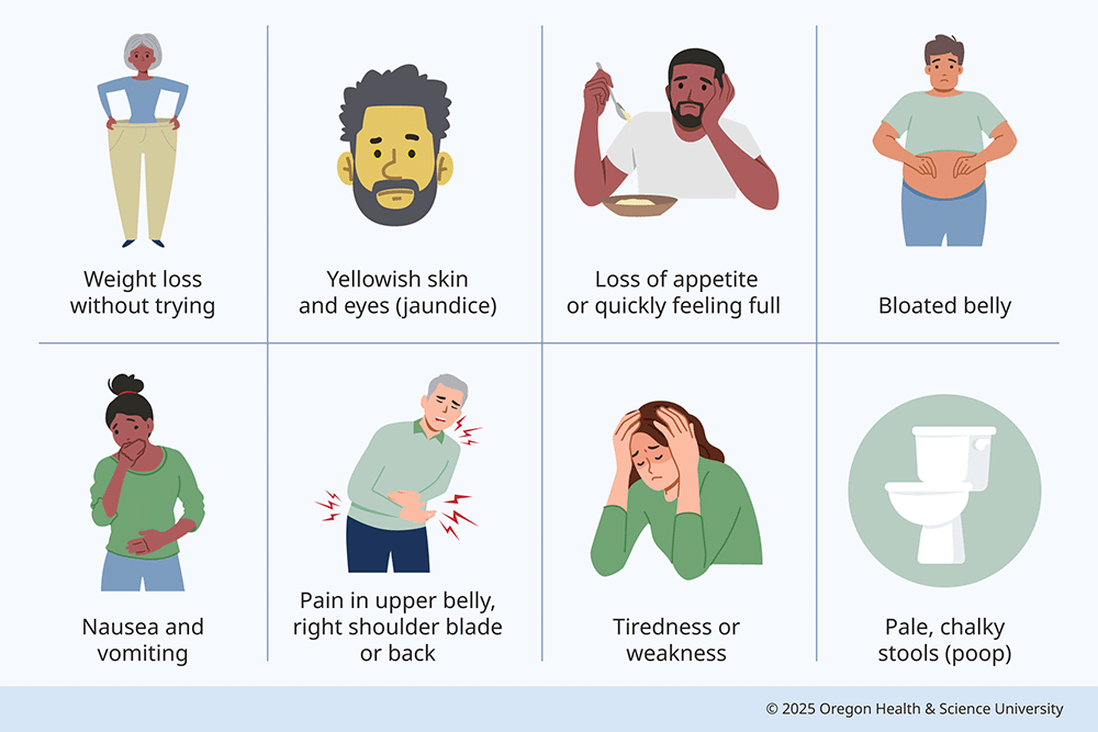 An illustration shows eight common symptoms of liver cancer: weight loss without trying; loss of appetite or quickly feeling full; pain in upper belly, right shoulder blade or back; bloated belly; nausea and vomiting; tiredness or weakness; yellowish skin and eyes (jaundice); pale, chalky stools (poop).