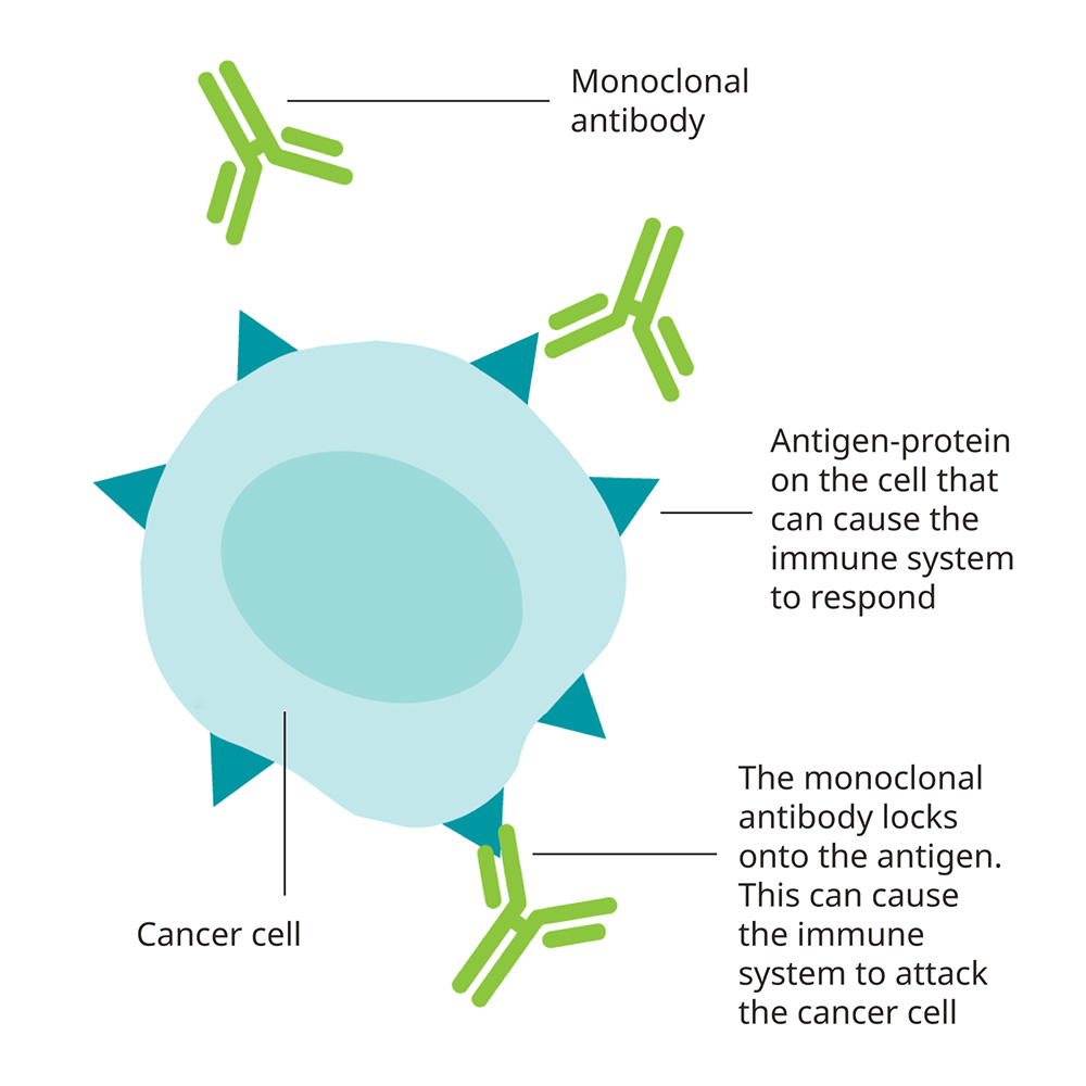 Monoclonal antibodies are synthetic proteins that bind to targets, such as a protein, on the surface of a cancer cell.
