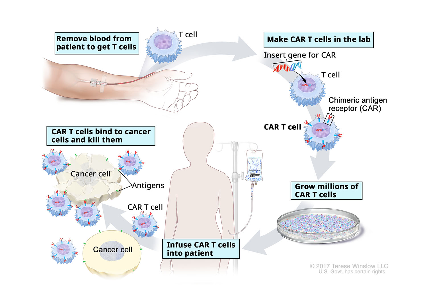Diagram of the process of CAR T-cell therapy.