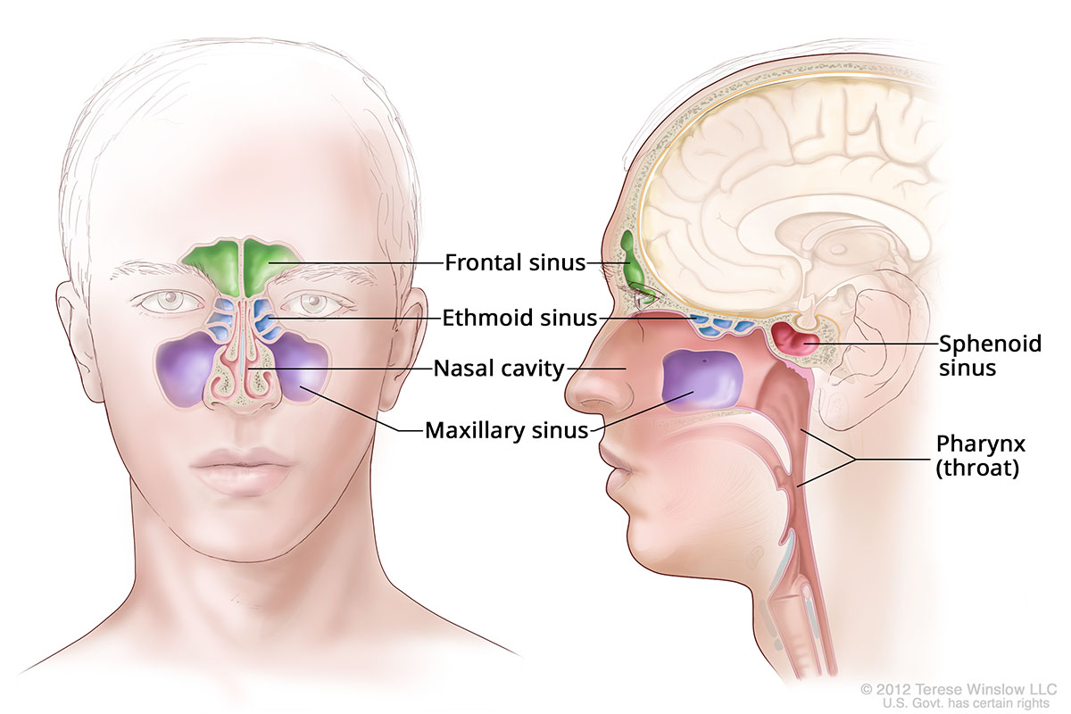 A drawing shows the paranasal sinuses from the front and side.