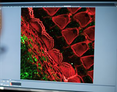 Desktop computer screen shows a magnified image of sensory cells for sound and balance in the inner ear.]