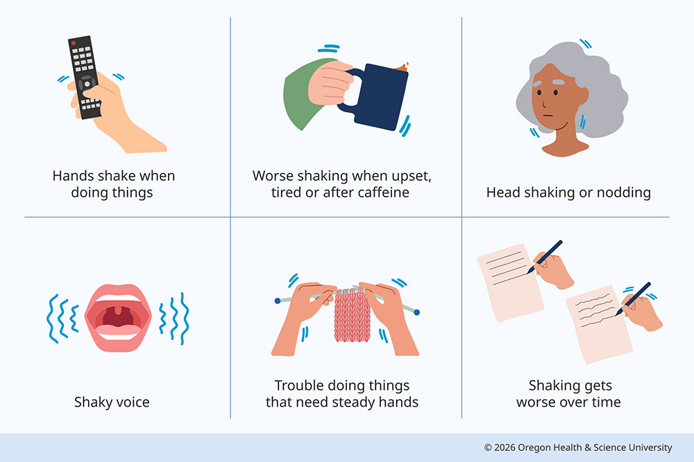 An illustration shows common symptoms of essential tremor: hands that shake when doing things; worse shaking when upset, tired or after caffeine; head shaking or nodding; shaky voice; trouble doing things that need steady hands; shaking gets worse over time.